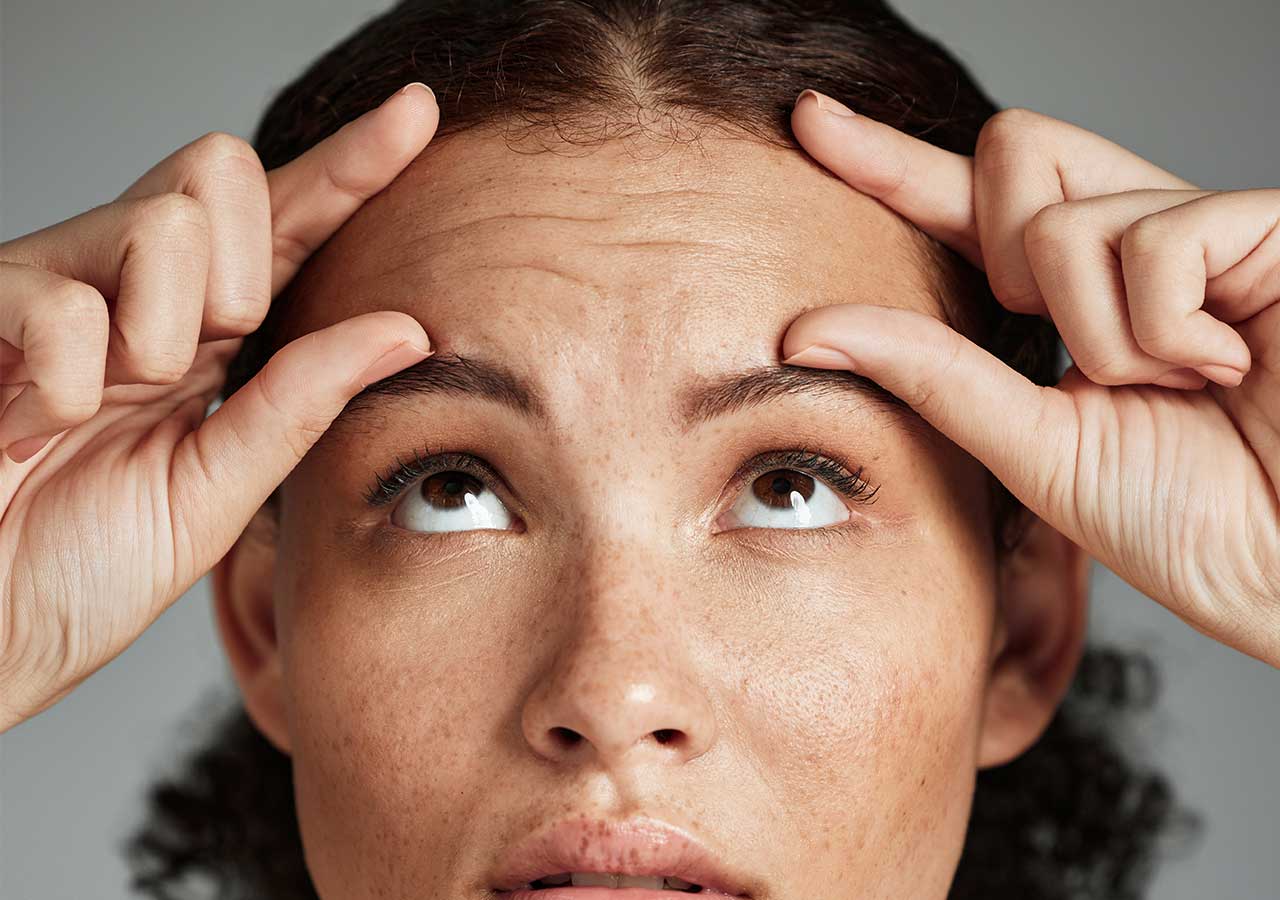 forehead lines on face