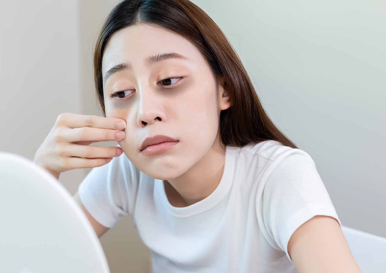 Are-Under-Eye-Hollows-Making-You-Look-Tired-or-Aged