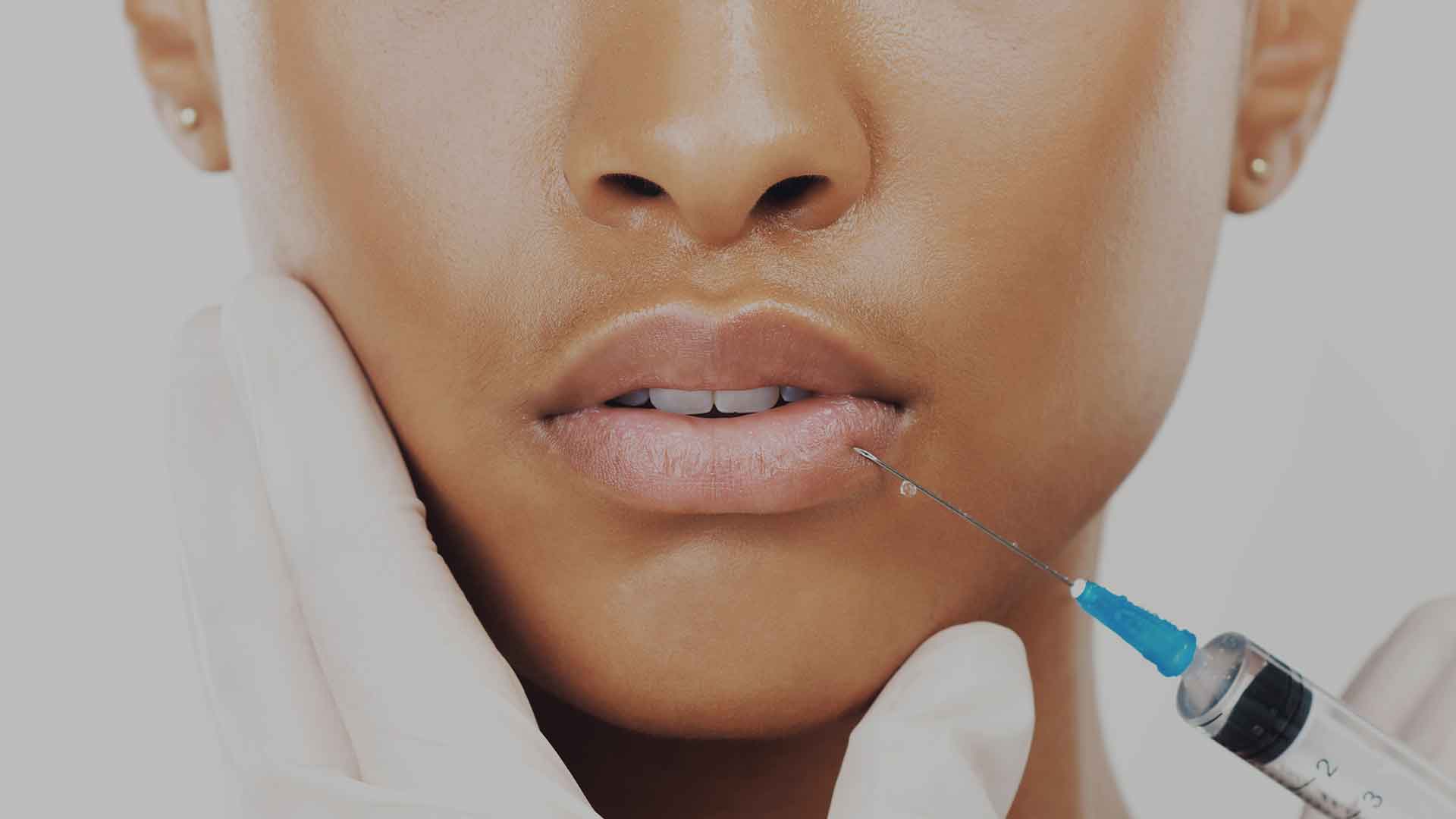 Lip-Enhancement-Monaz-Clinic