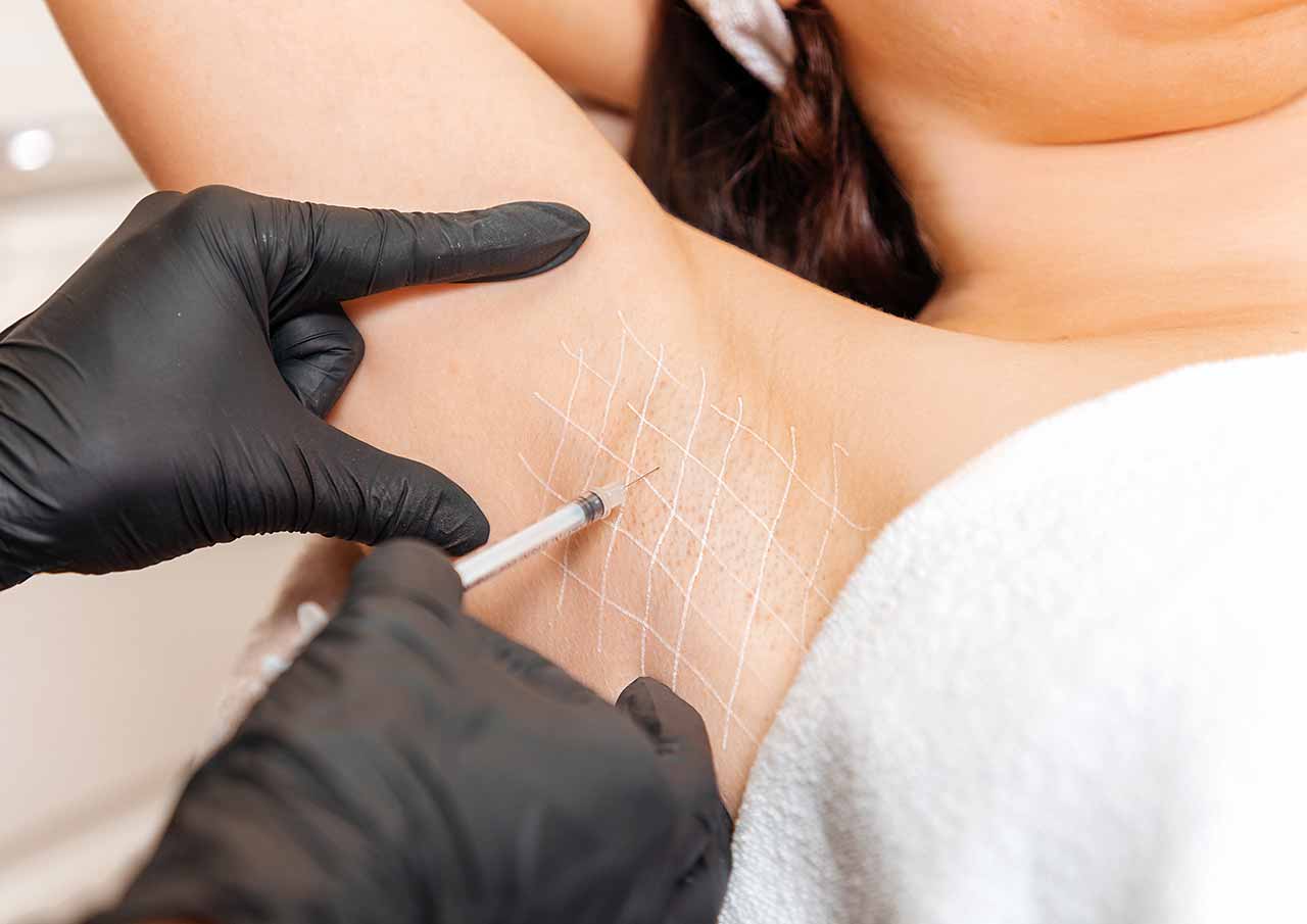 Monaz-Clinic-hyperhidrosis-treatment-process