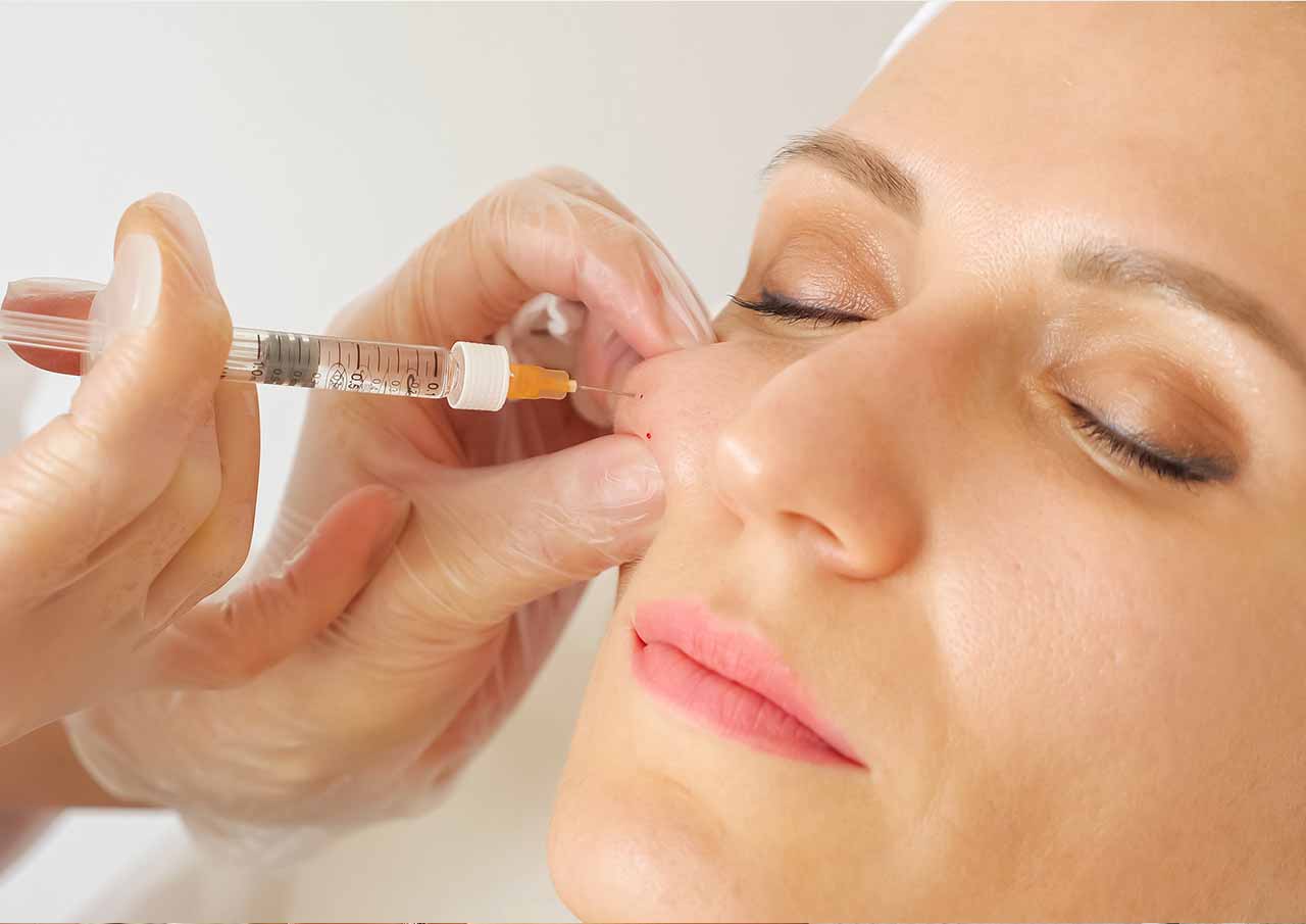 Monaz-clinic-Why-We-Use-These-Brands-for-cheek-Enhancement