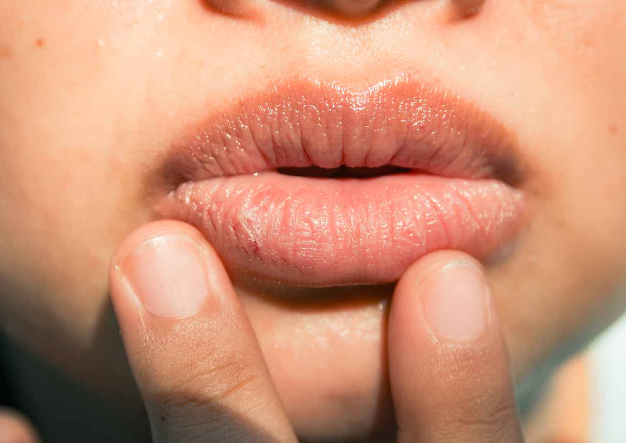 Plumper-More-Attractive-Lips-Without-Surgery