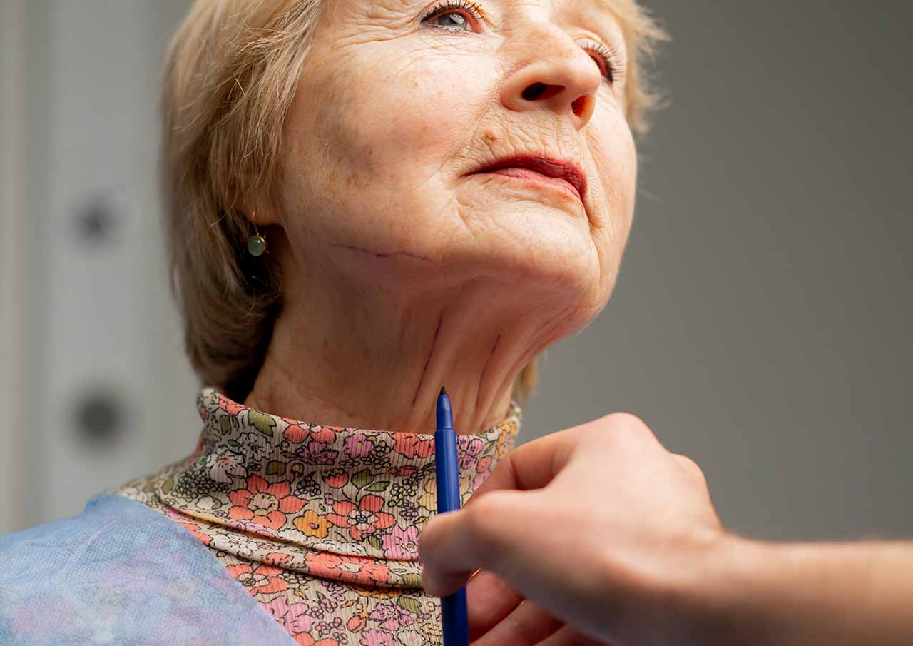 Sagging-Skin-or-Jowls-Affecting-Your-Confidence