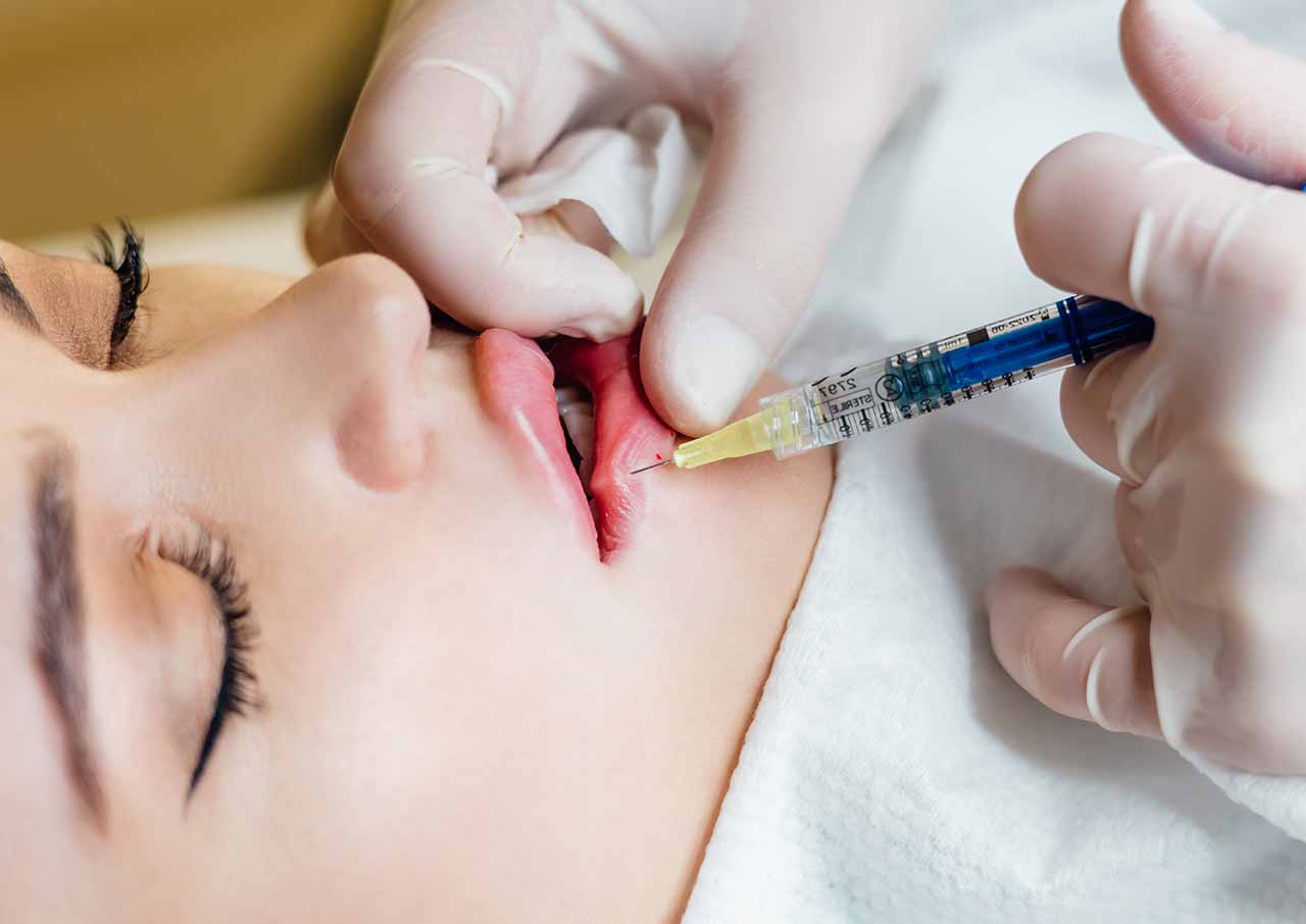 Why-Choose-Dermal-Fillers-for-Lip-Enhancement