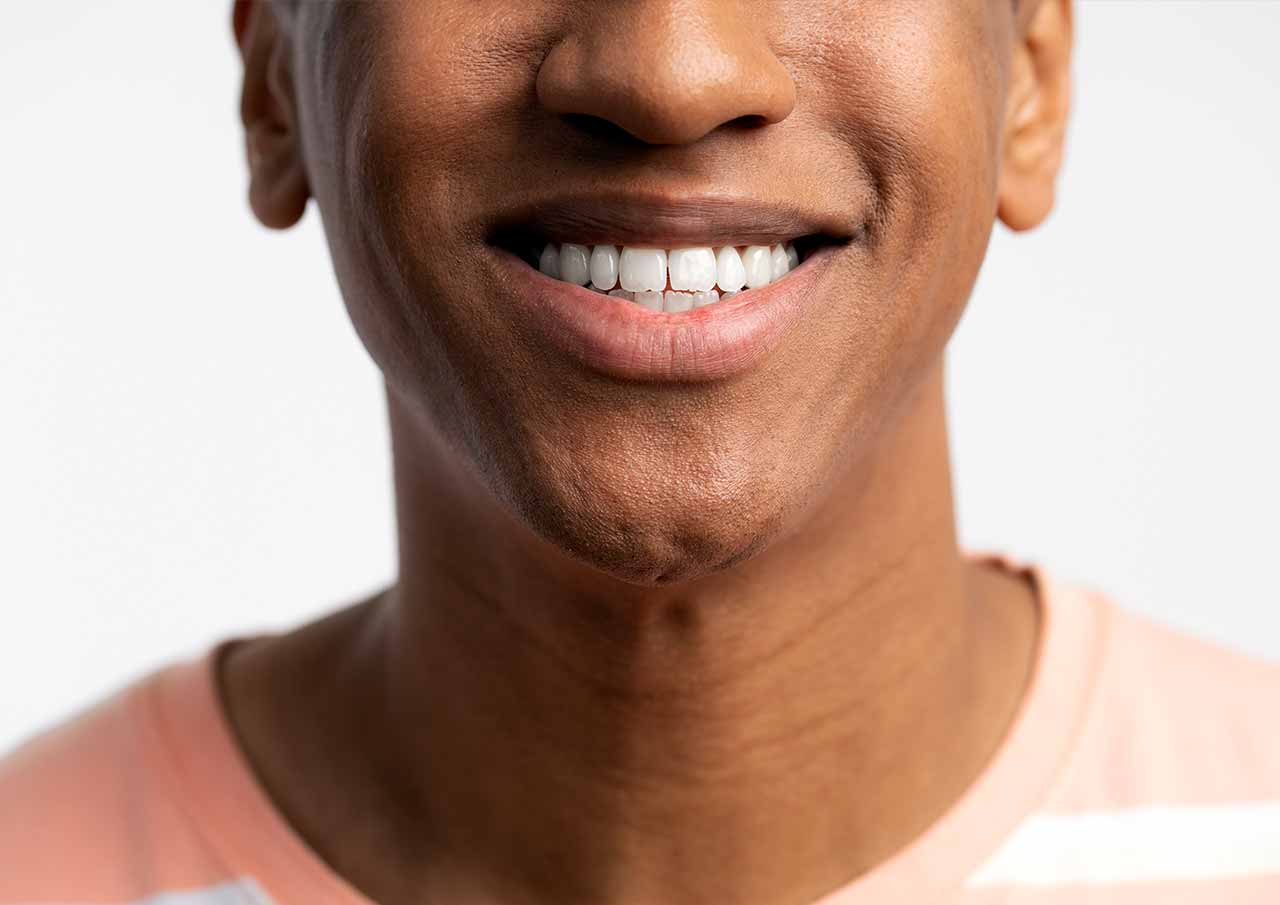 chin-dimples-treatment