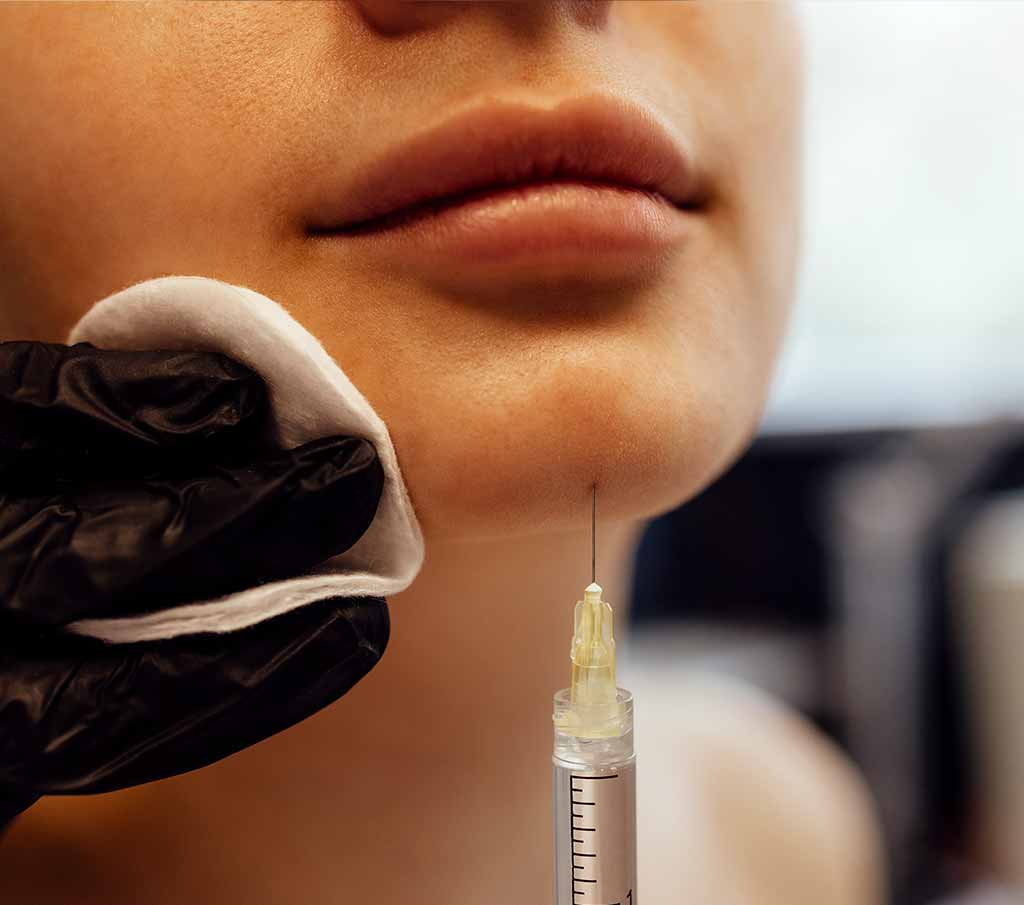 how does chin bimples treatment work