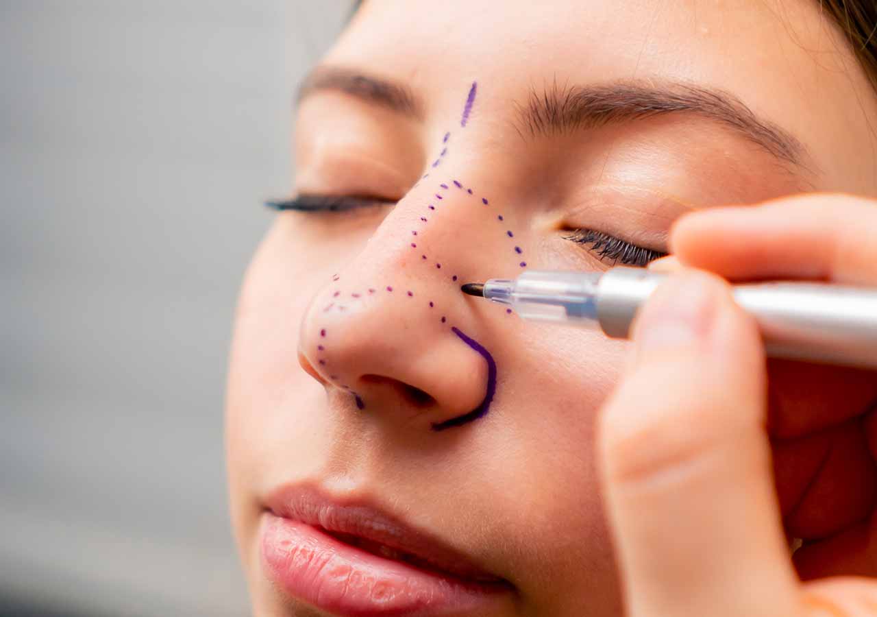 hows treatment work bunny lines