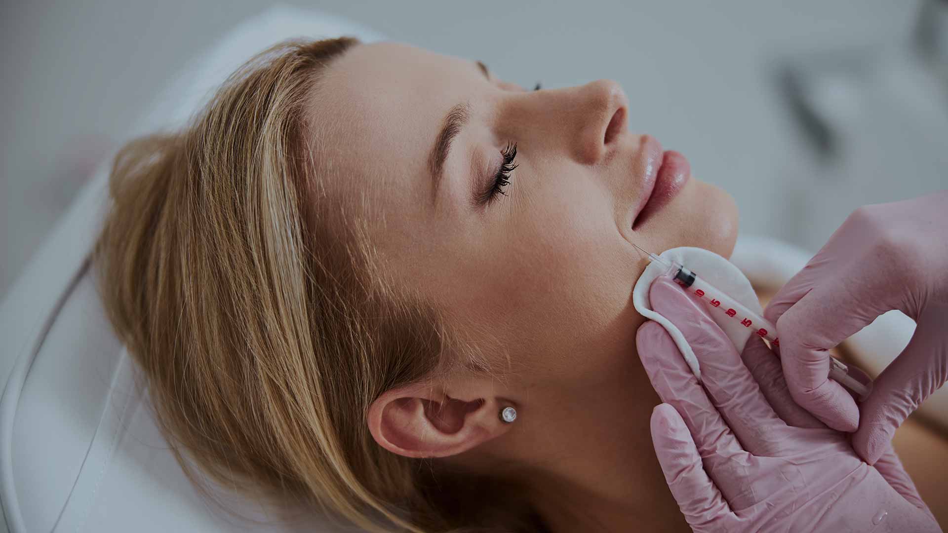 monaz-header-Nasolabial-Folds