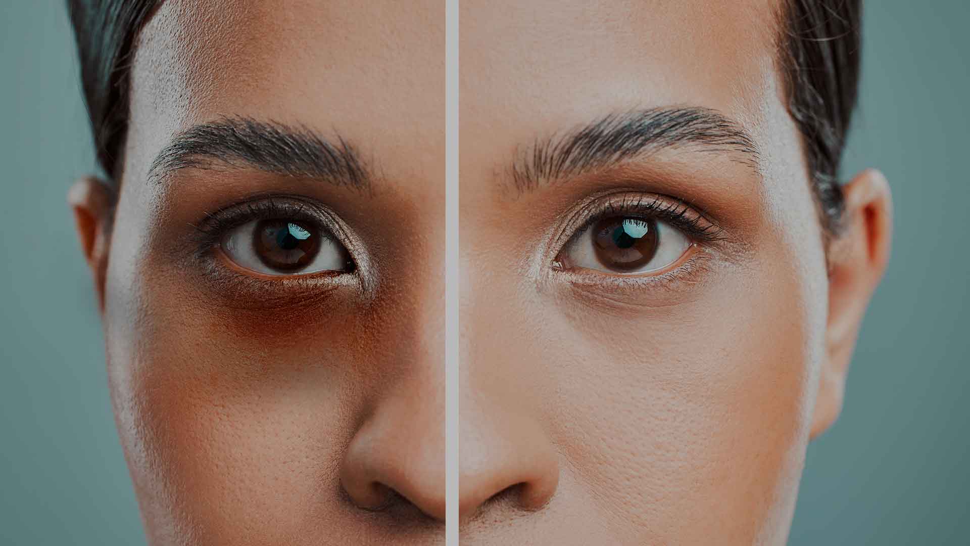 monaz-header-under-eye-hollows