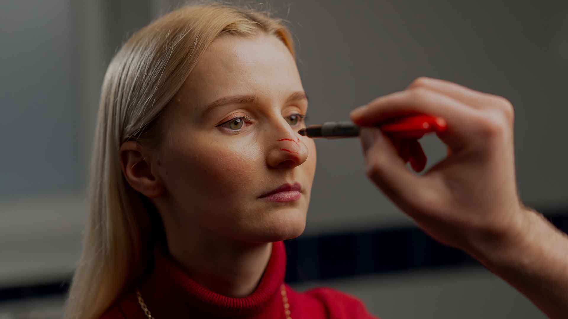 nose-wrinkles-monaz-clinic