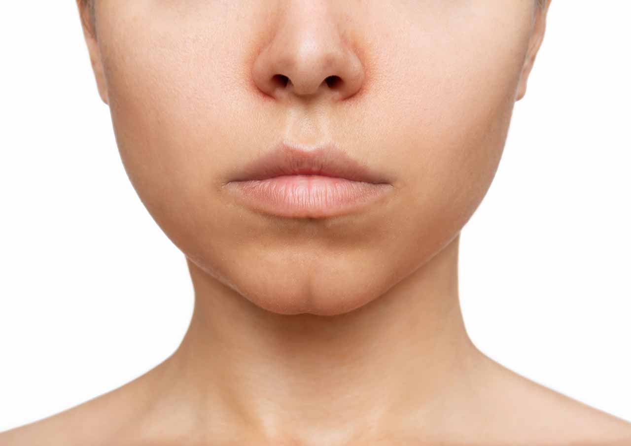 who-is-chin-dimples-treatment-for